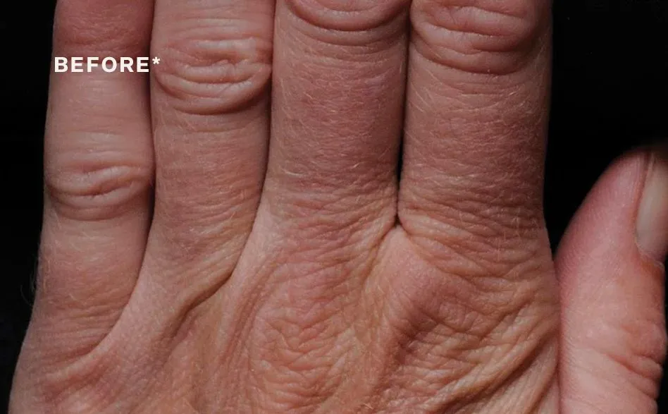 StriVectin Volumizing Hand Cream krém na ruce 60 ml