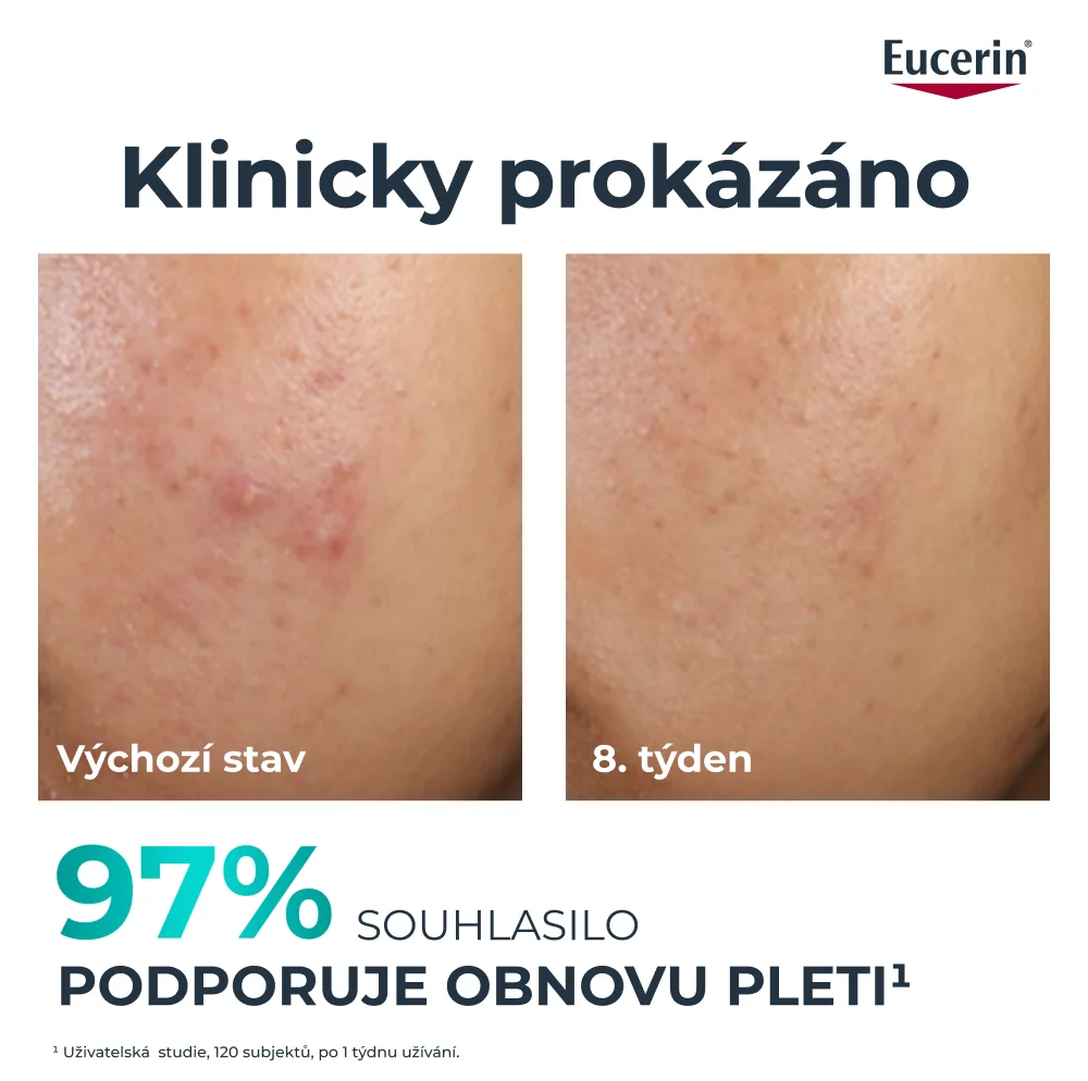 Eucerin DermoPure Clinical 10% peeling 40 ml