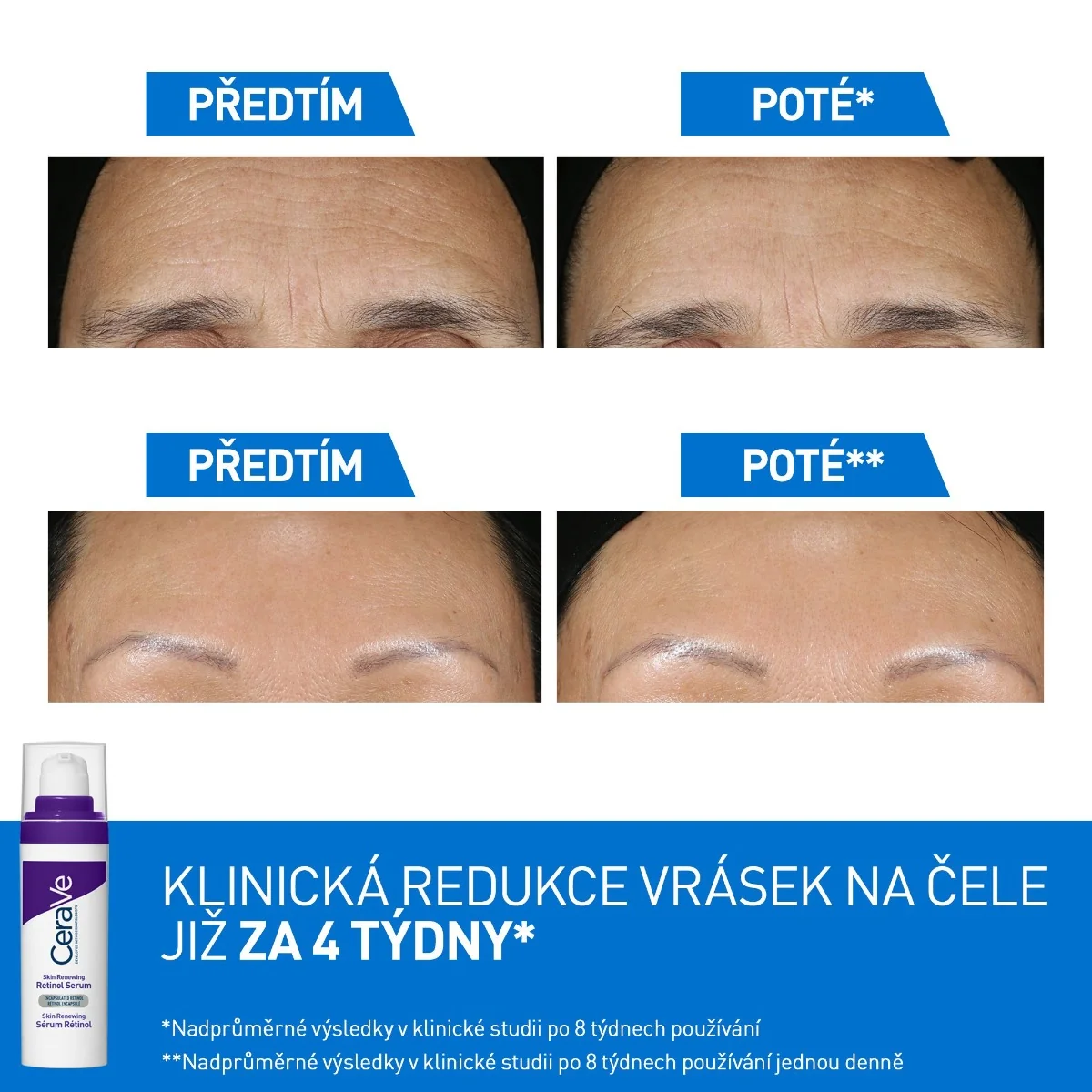 CeraVe Retinolové sérum na obnovu pleti 30 ml