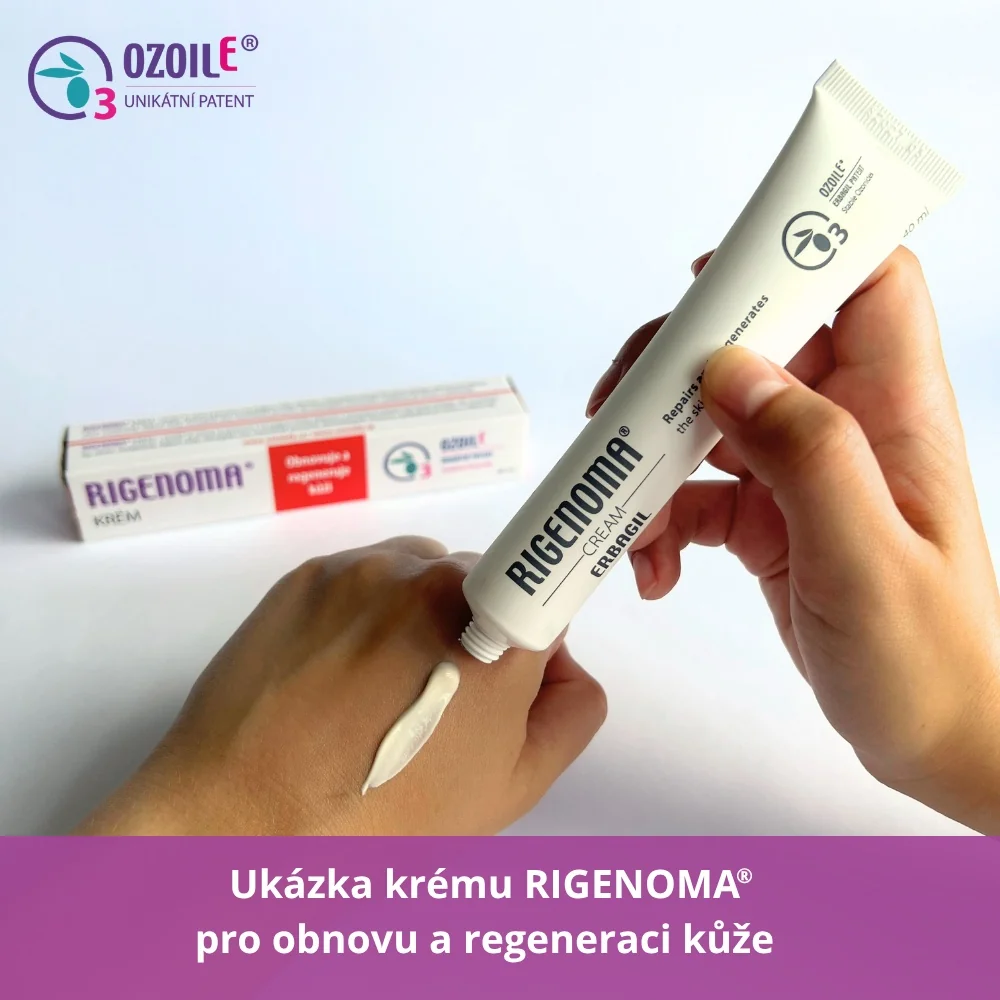 RIGENOMA krém pro obnovu a regeneraci kůže s OZOILE 40 ml