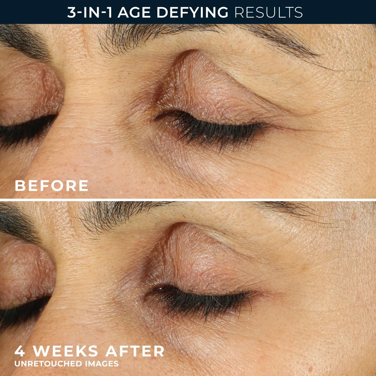RoC Retinol Correxion Line Smoothing oční krém 15 ml