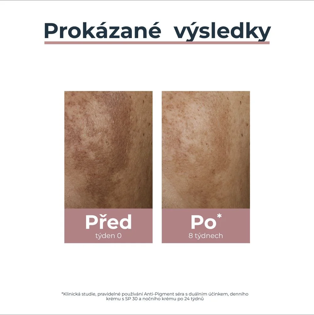 Eucerin AntiPigment sérum s duálním účinkem 30 ml