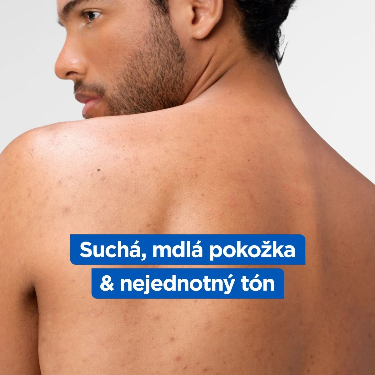 Mixa Niacinamide Bright Tělové mléko 250 ml