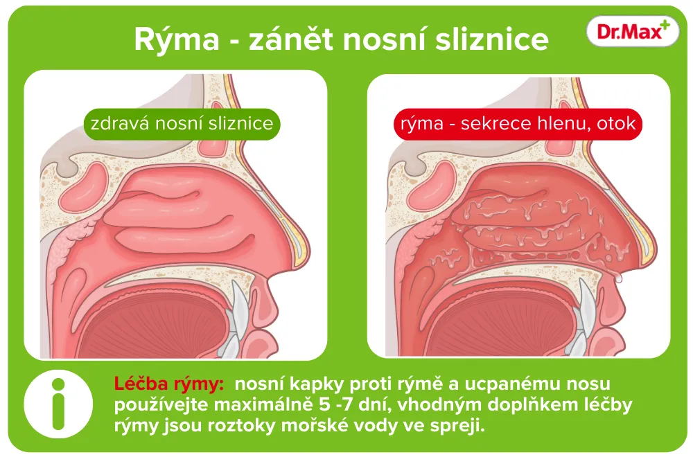 Jak dlouho je přenosná rýma?