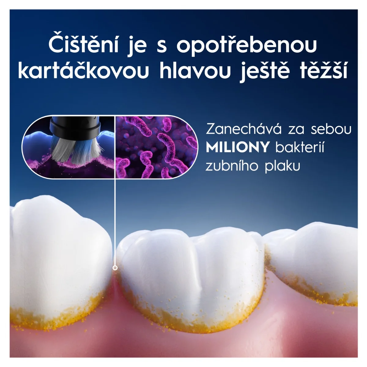 Oral-B iO Series Gentle Care kartáčkové hlavy 4 ks bílé