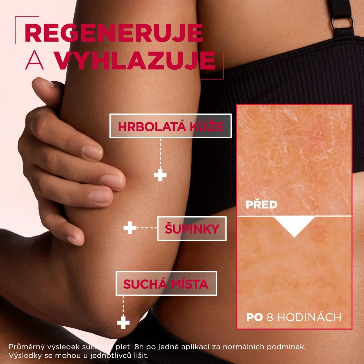 Mixa Urea Cica Repair+ Obnovující krém na velmi suchou pokožku 150 ml