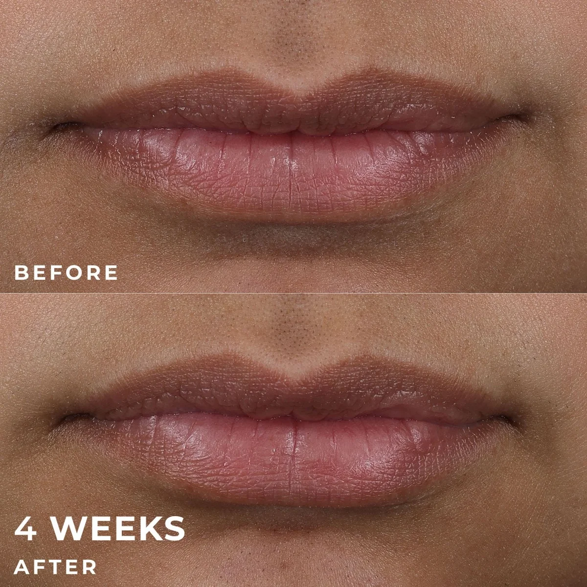 RoC Derm Correxion Lip Volumizer péče pro plnější rty 10 ml