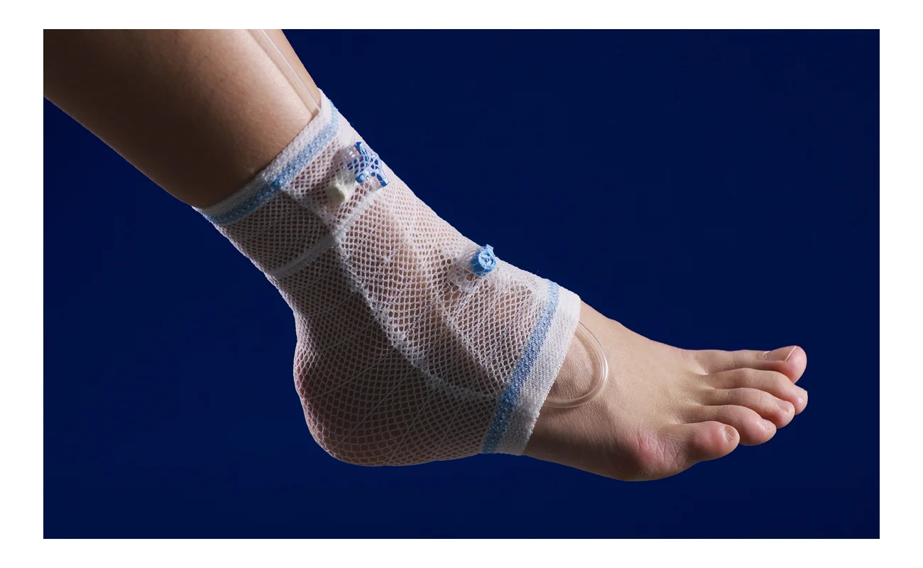 CareFix Tube vel. XL elastický síťový obvaz 15 ks