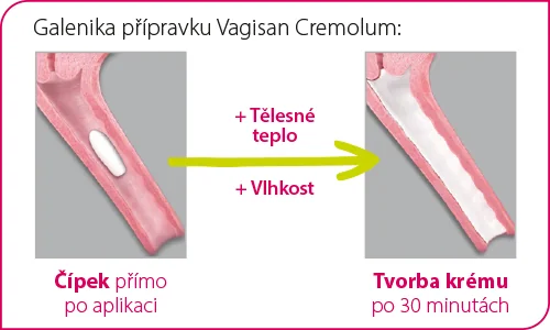 Pro ženy, které nechtějí používat aplikátor, je zde Vagisan HydroKrém Cremolum. Pro ženy, které nechtějí používat aplikátor, je zde Vagisan HydroKrém Cremolum.