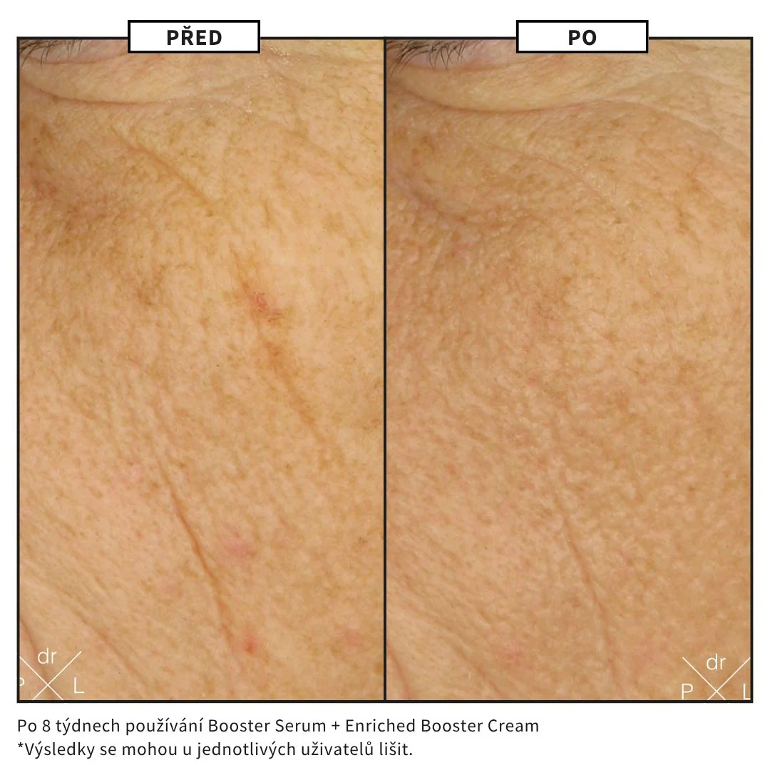 Dr. LEVY Anti-aging krém na zralou a suchou pleť 50 ml