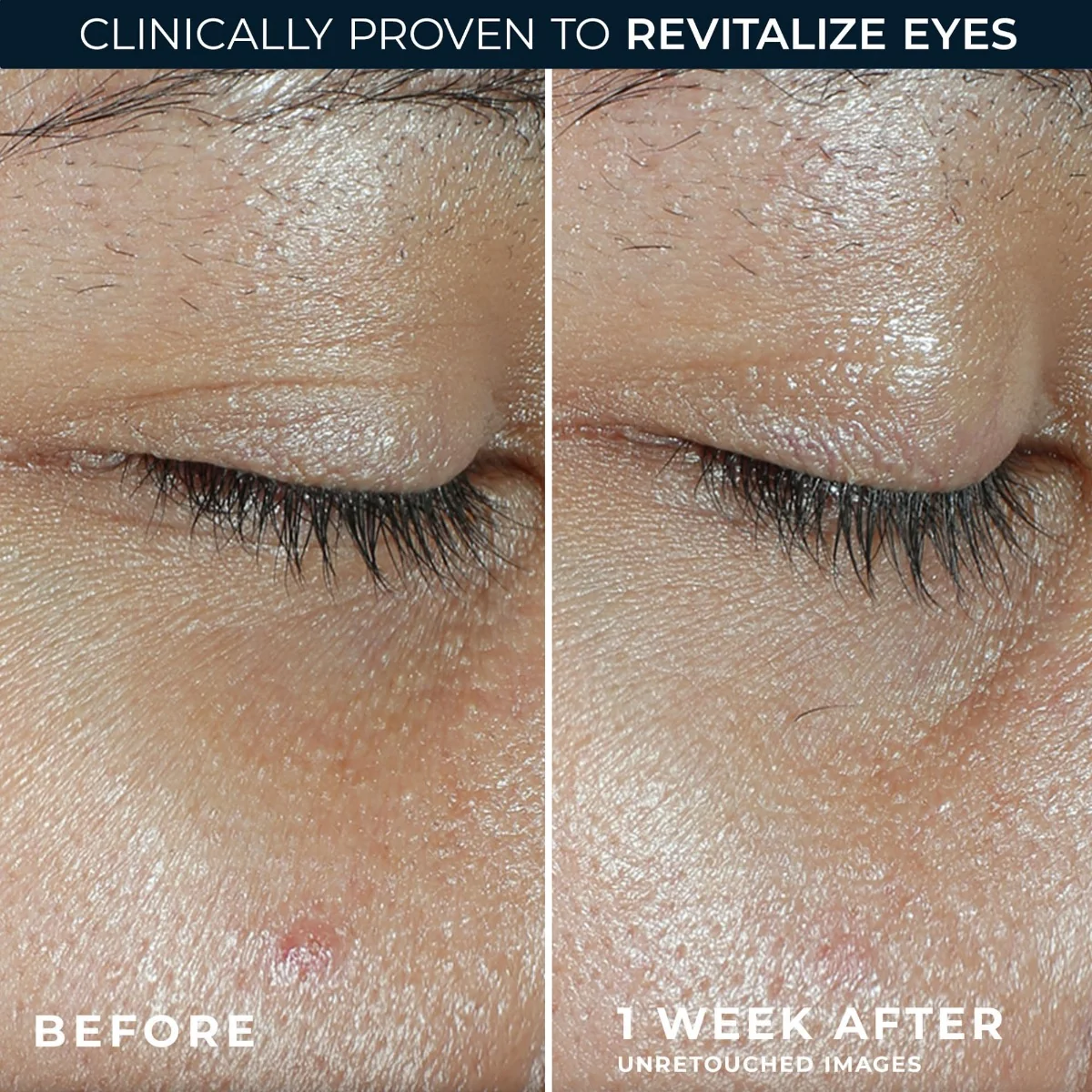 RoC Multi Correxion Revive + Glow oční balzám 4 g