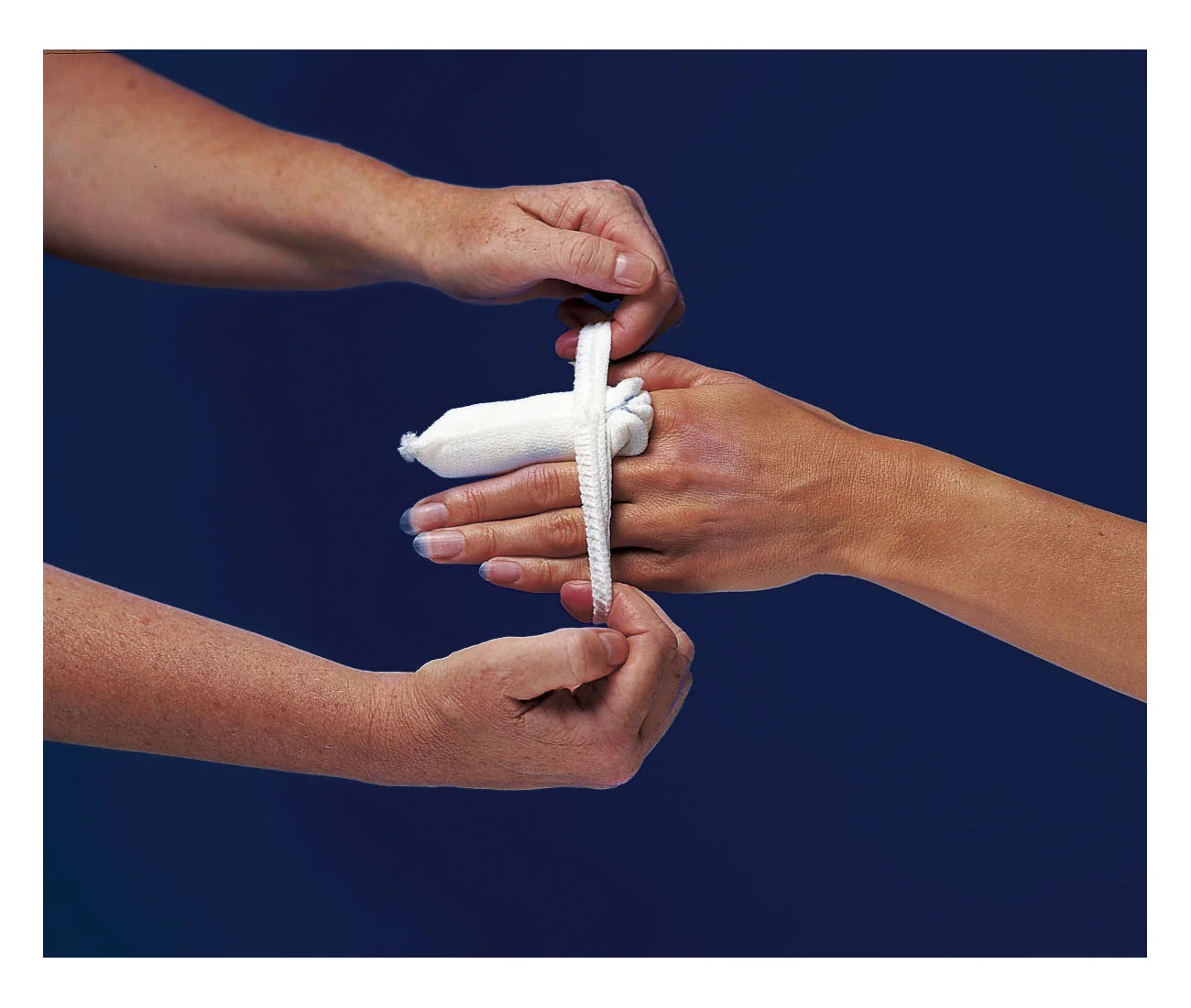 CareFix Finger/Toe vel. S elastický síťový obvaz 20 ks