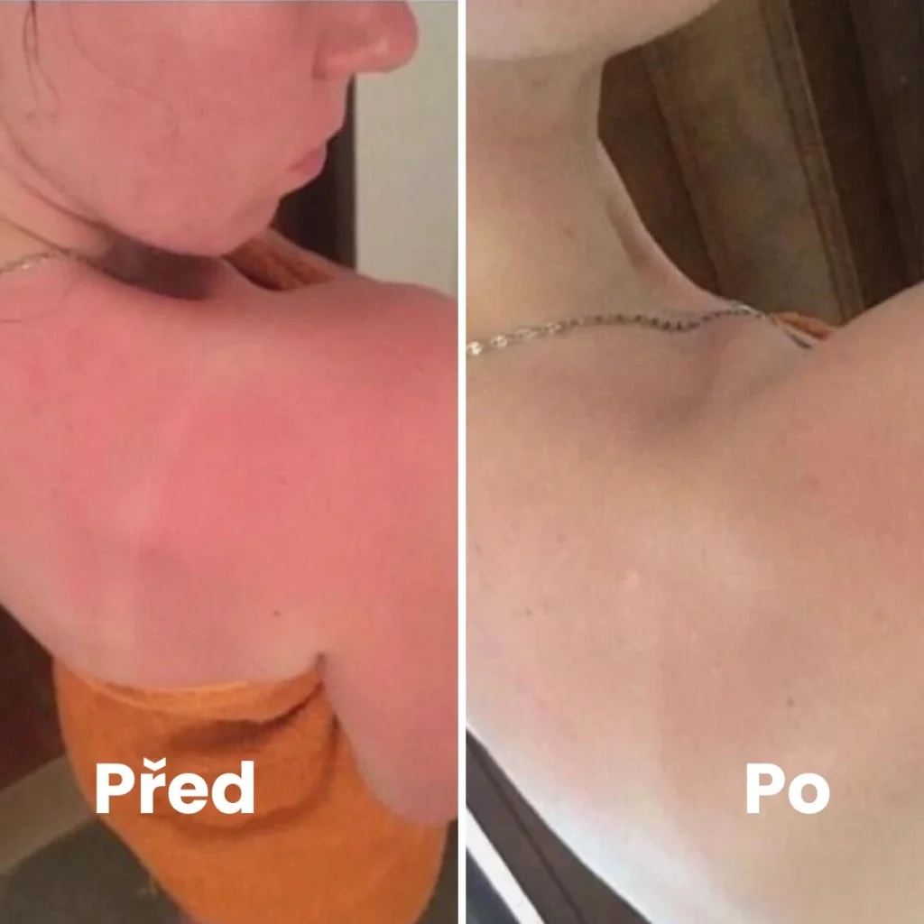 Renovality Meruňkový olej za studena lisovaný 100 ml
