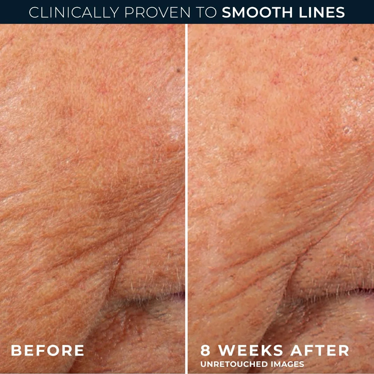 RoC Retinol Correxion Line Smoothing noční sérum 30 kapslí