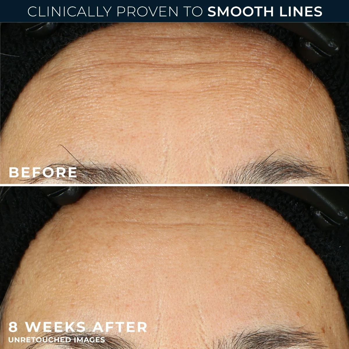 RoC Retinol Correxion Line Smoothing noční sérum 30 kapslí