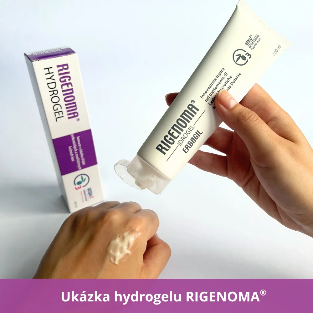 RIGENOMA hydrogel na rány s OZOILE 100 ml