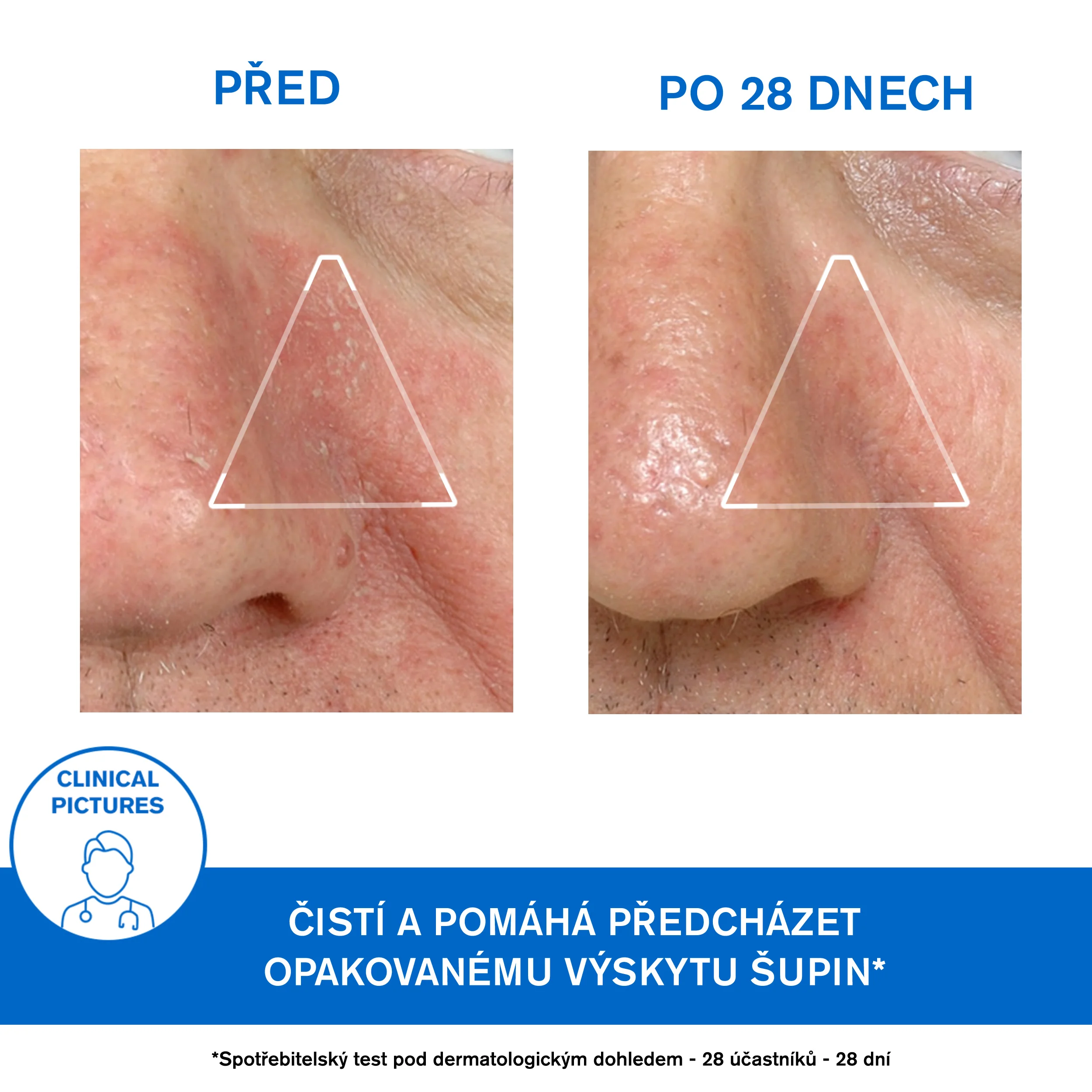 Uriage DS Zklidňující emulze proti lupům 40 ml