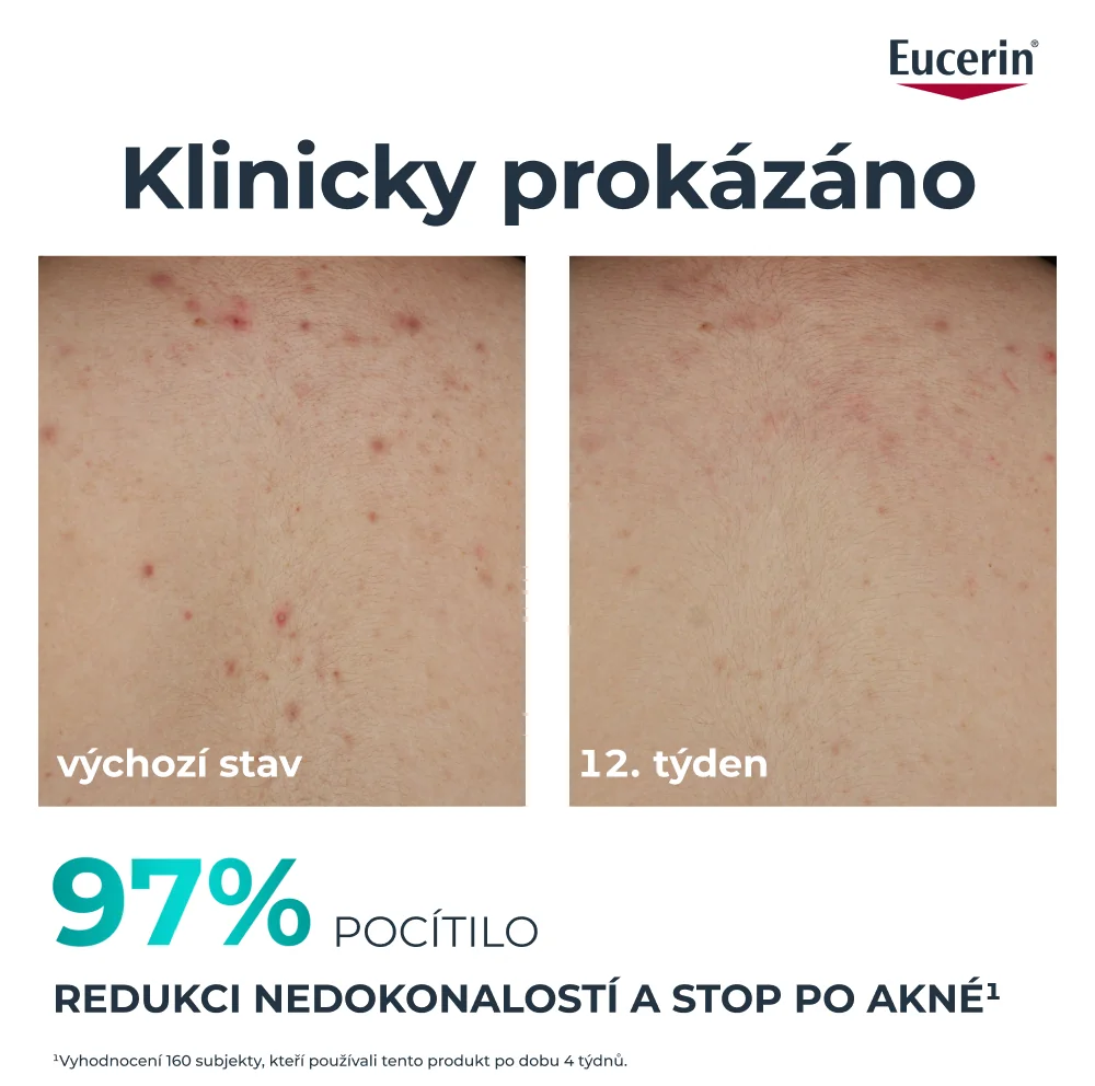 Eucerin DermoPure Clinical Tělový krém 200 ml