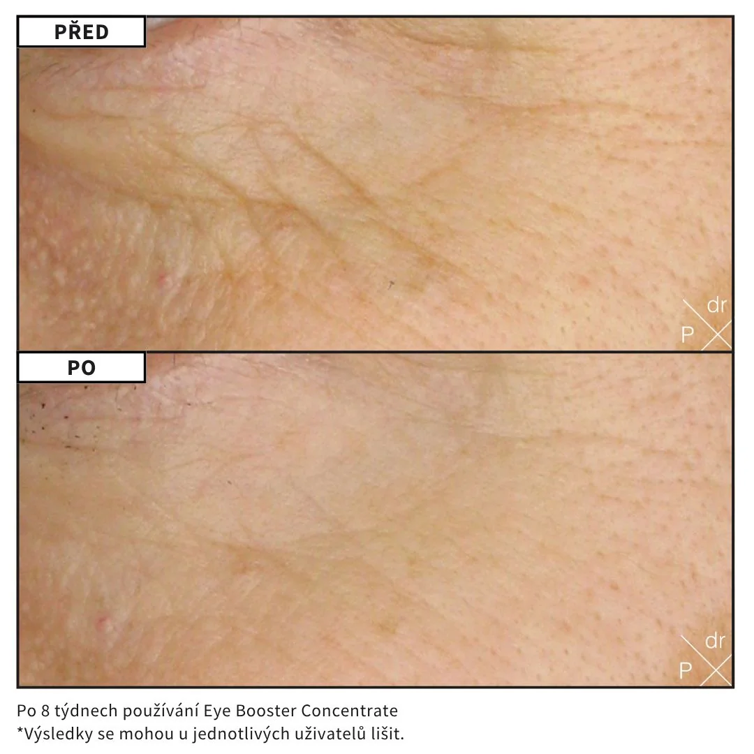 Dr. LEVY Omlazující oční koncentrát s ArganCellActiv 15 ml