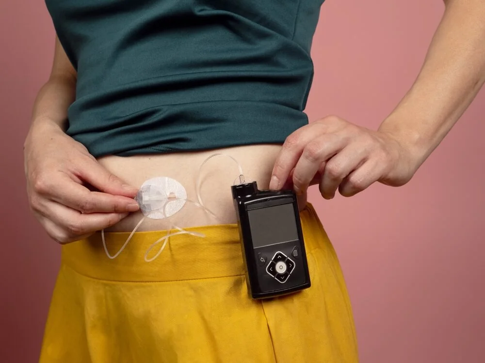 Inzulinová pumpa pro diabetiky