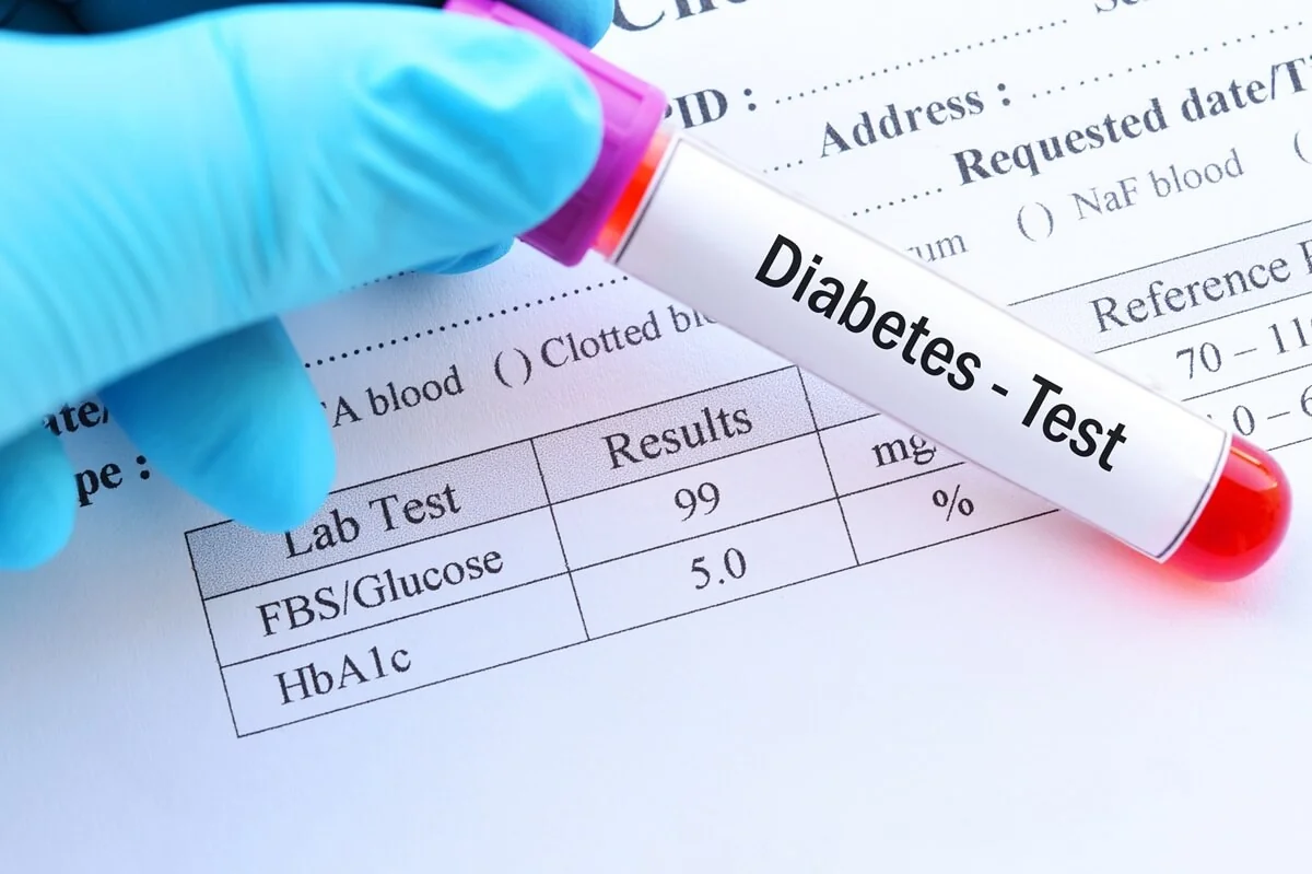 Glykovaný hemoglobin – proč je důležité ho sledovat?