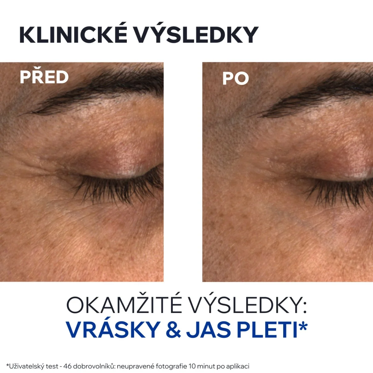 Uriage Age Absolu Zpevňující oční balzám 15 ml