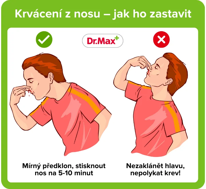 Jak zastavit krvácení z nosu - ilustrace. Jak zastavit krvácení z nosu - ilustrace.