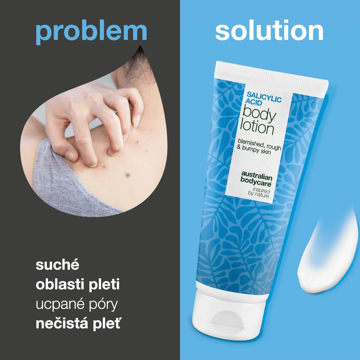 Australian Bodycare Salicylic Body Lotion 200 ml