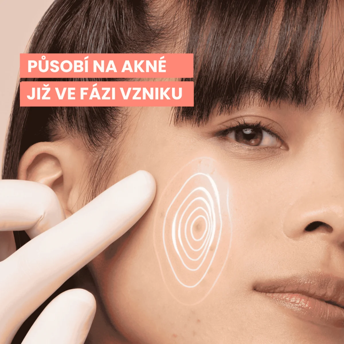 Avène Cleanance ComedoMed+ Intenzivní péče proti nedokonalostem pleti 30 ml