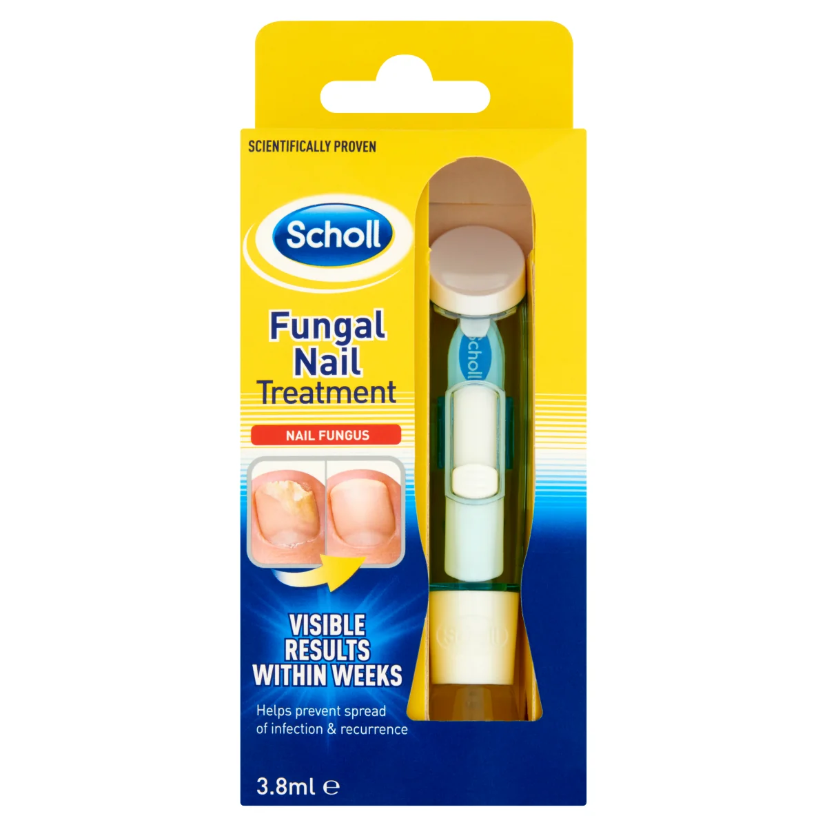 Scholl 2v1 kúra na nehtovou mykózu s pilníky 3,8 ml