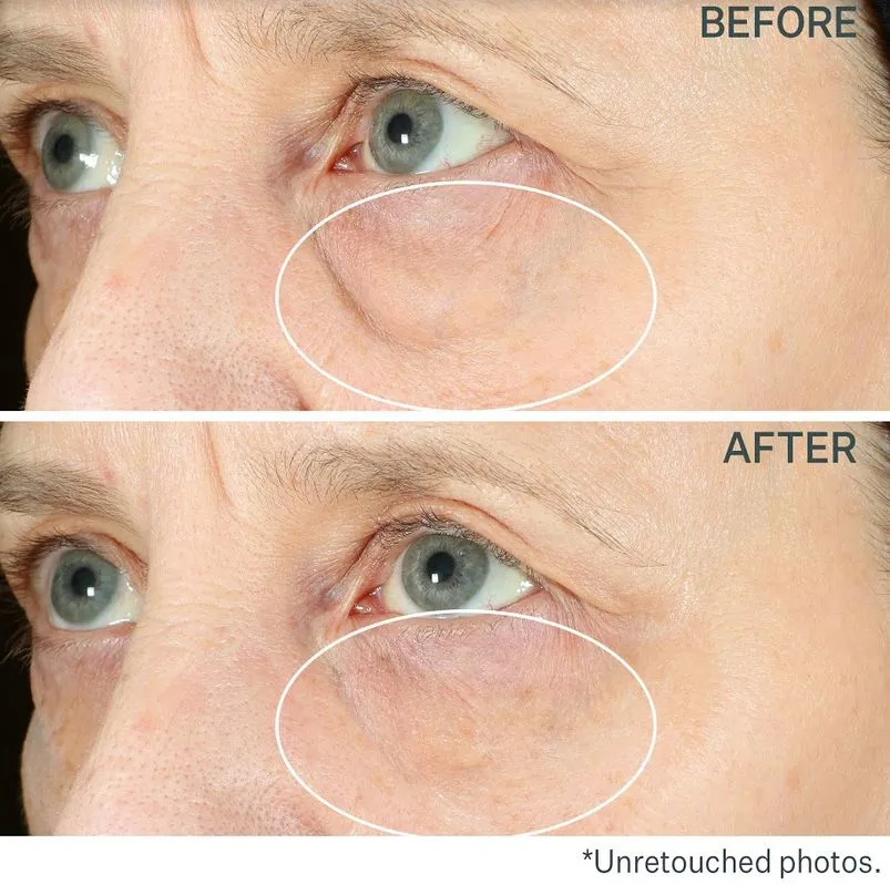 StriVectin TL Hyperlift Eye Instant Eye Fix krém na oční vaky 10 ml