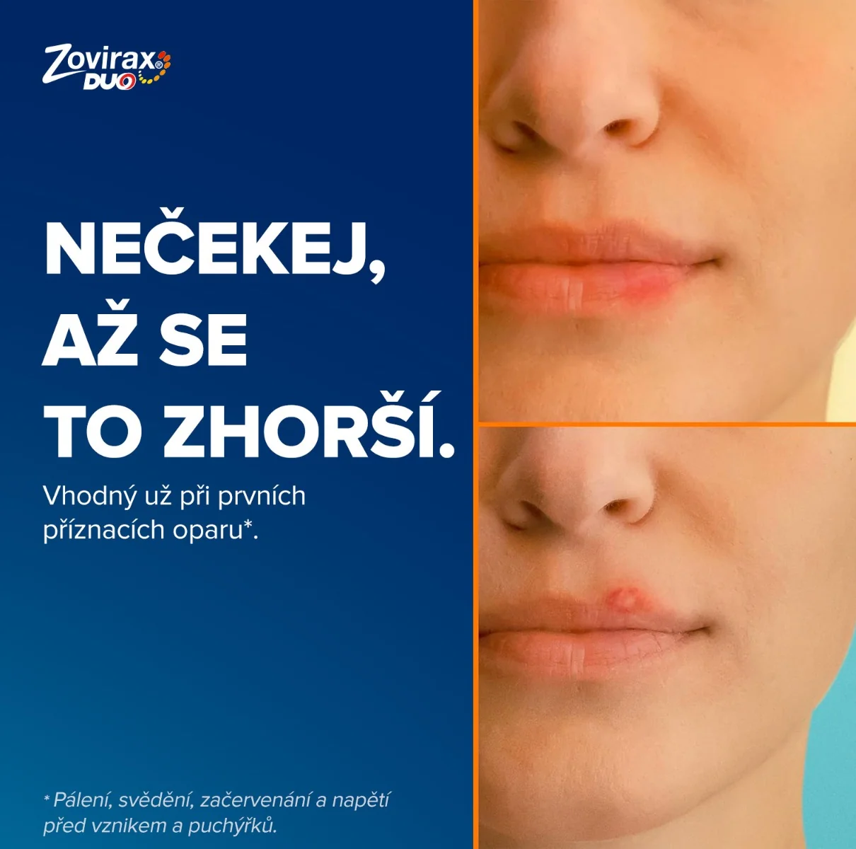 Zovirax Duo krém na opary 2 g