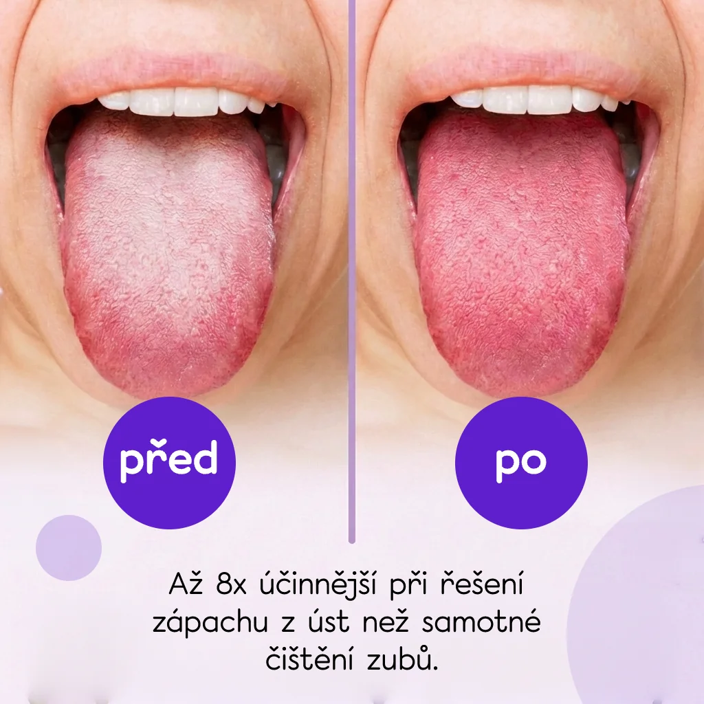 Hello Coco Tongue Sraper škrabky na jazyk 5 ks