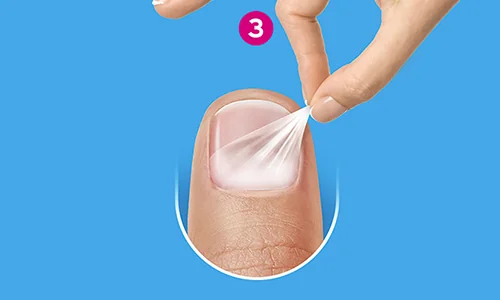 Jak přípravek Excilor® Forte aplikovat? Krok 3 Jak přípravek Excilor® Forte aplikovat? Krok 3
