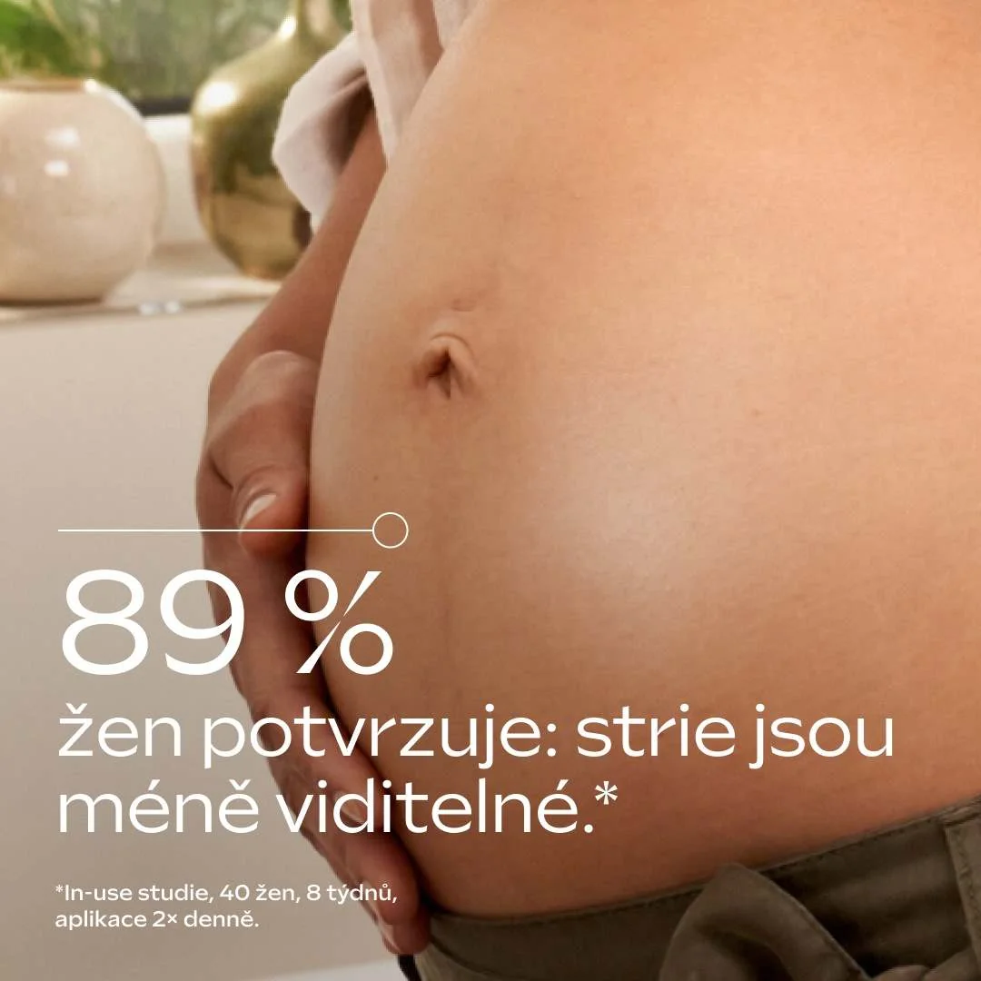 Weleda Mama Tělové máslo proti striím 150 ml