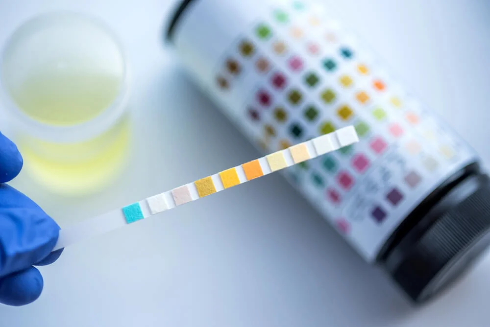 Diabetická ketoacidóza se snadno potvrdí prostřednictvím domácích testovacích proužků. Diabetická ketoacidóza se snadno potvrdí prostřednictvím domácích testovacích proužků.