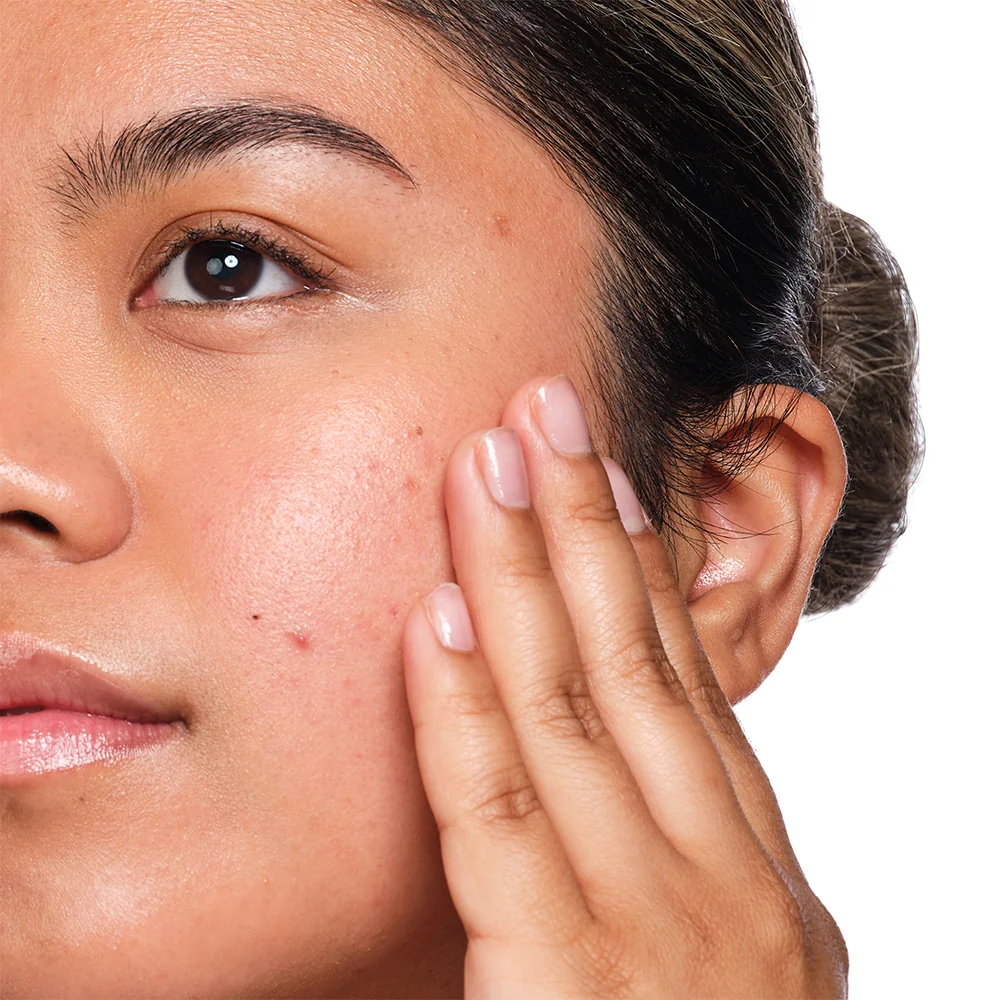 The Ordinary Salicylic Acid 2% Solution sérum s kyselinou salicylovou 30 ml