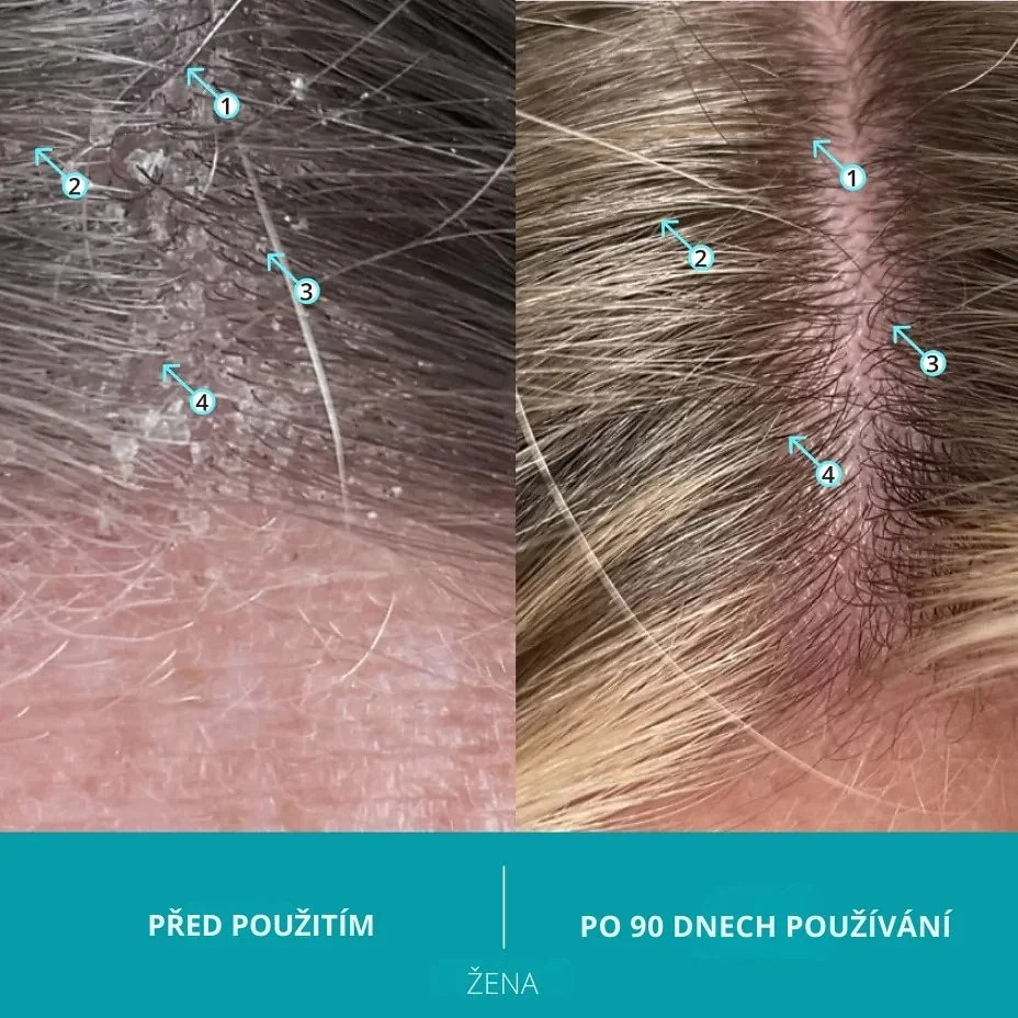 DS Laboratories Dandrene šampon proti lupům 205 ml