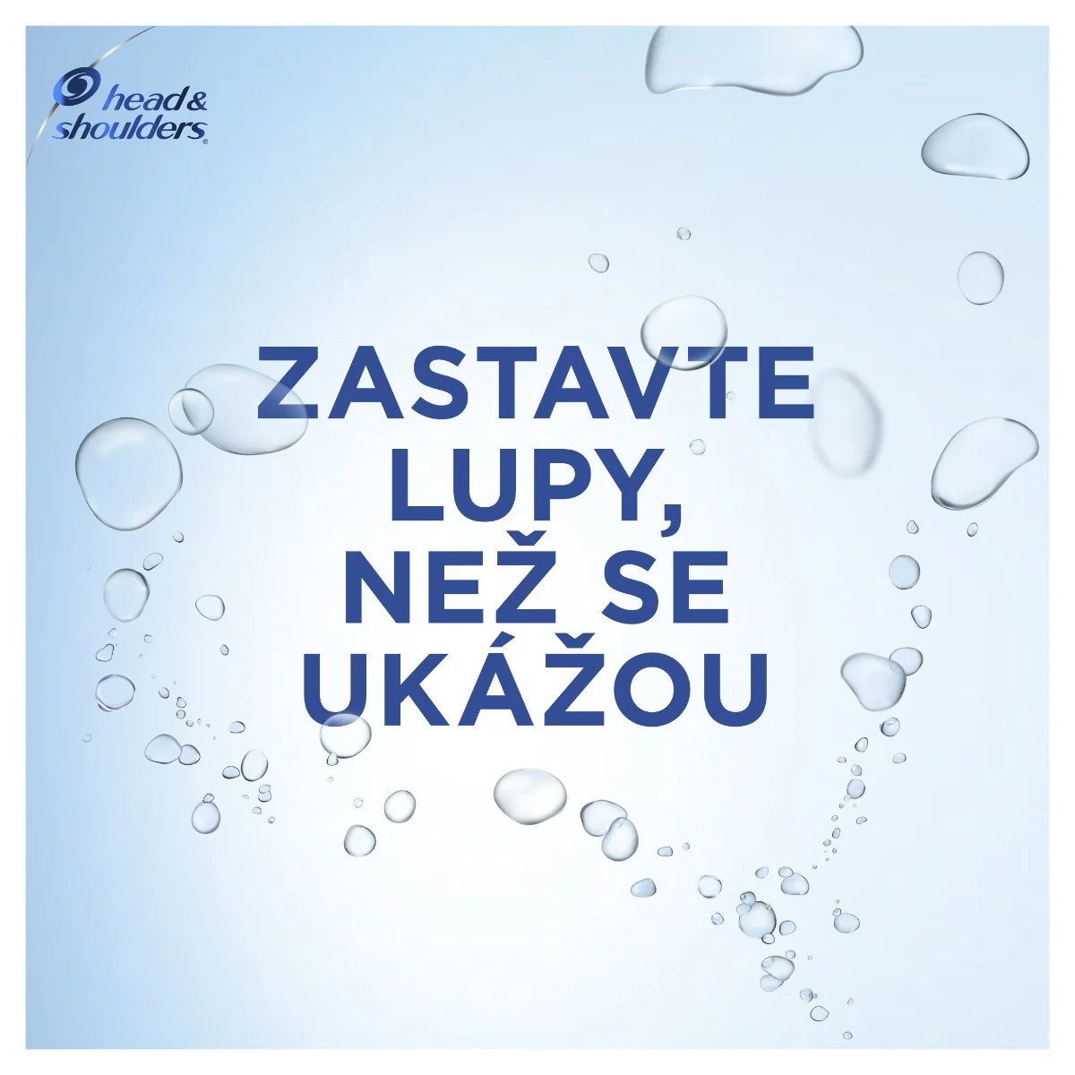 Head&Shoulders Citrus Fresh šampon proti lupům 400 ml