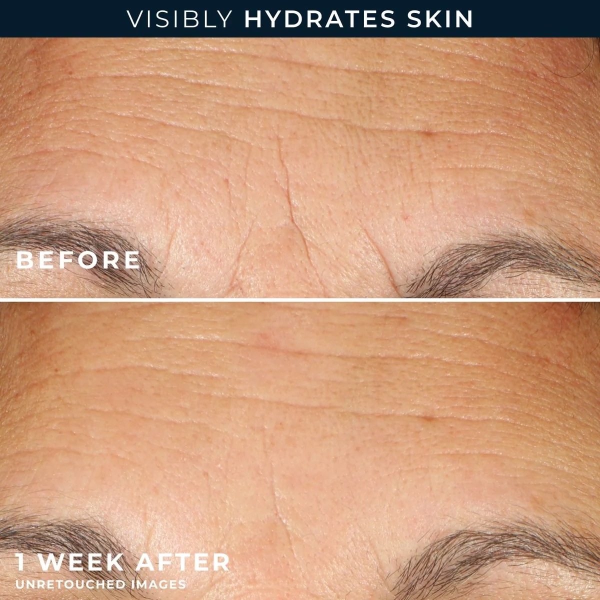 RoC Multi Correxion Hydrate + Plump sérum 30 kapslí