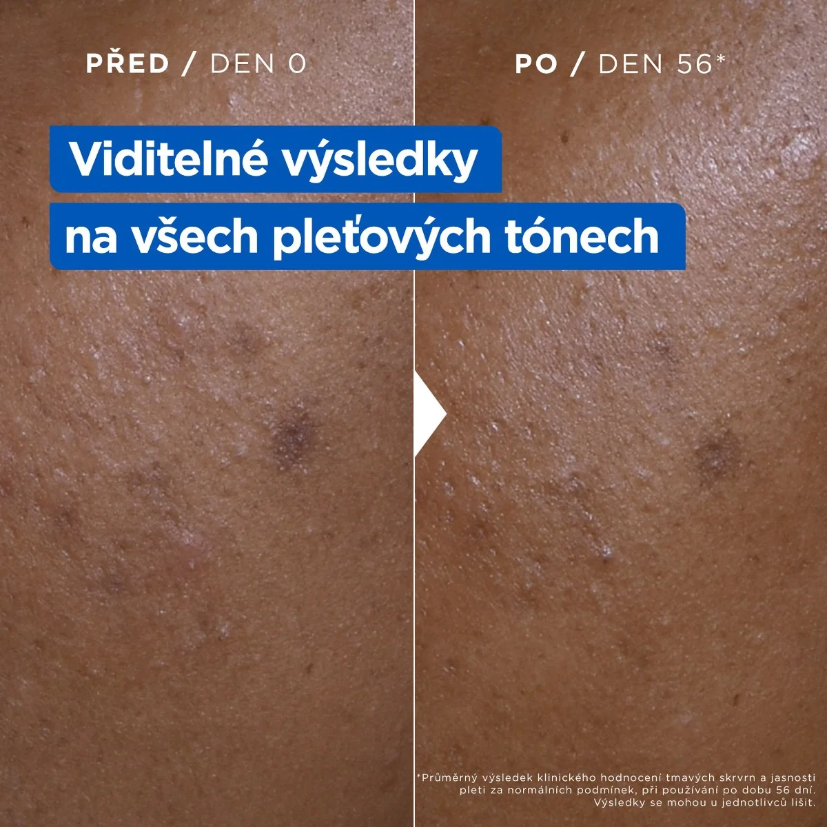 Mixa Niacinamide Bright Hydratační krém proti tmavým skvrnám 400 ml