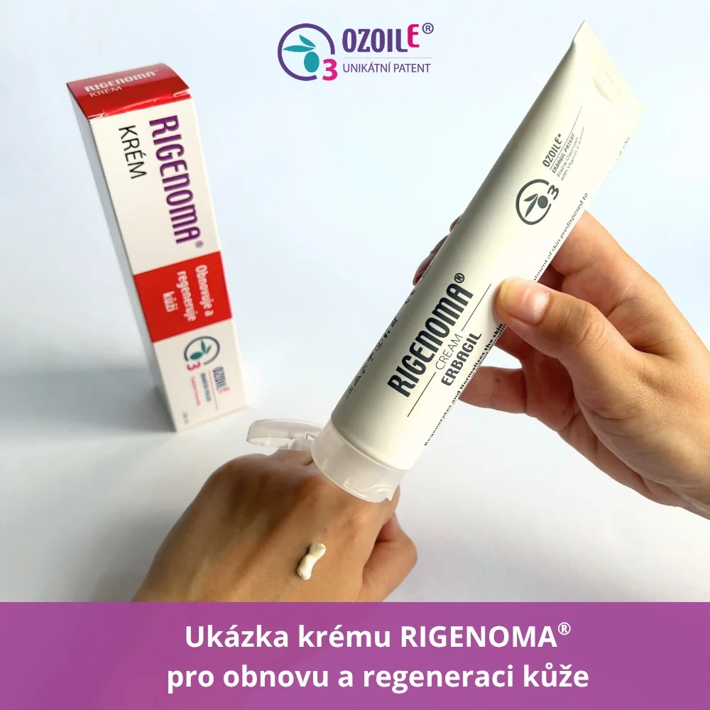 RIGENOMA krém pro obnovu a regeneraci kůže s OZOILE 100 ml