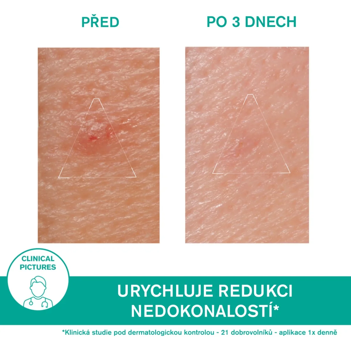 Uriage Hyséac Čisticí odličovací olej 100 ml