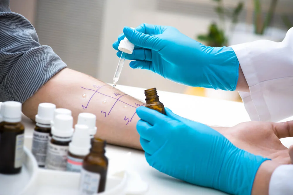 Alergii na kočku můžete zjistit po provedení téměř bezbolestného prick testu. Alergii na kočku můžete zjistit po provedení téměř bezbolestného prick testu.
