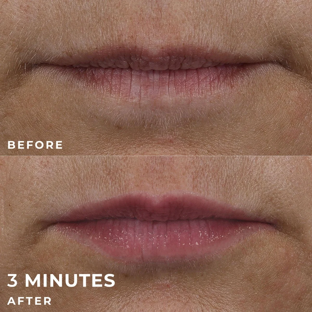 RoC Derm Correxion Lip Volumizer péče pro plnější rty 10 ml