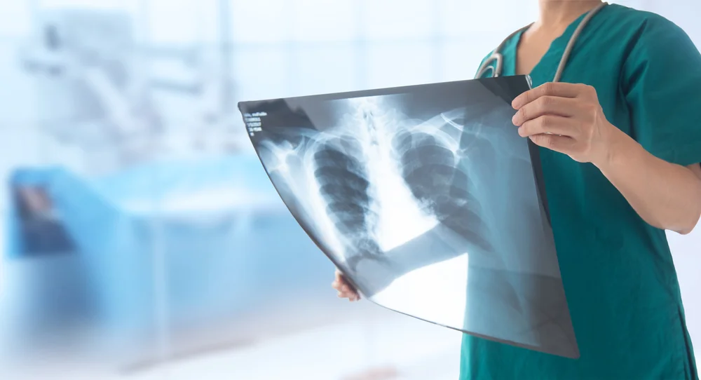 Potvrzení diagnózy tuberkulózy je náročné nejen pro pacienta, ale také pro nejbližší okolí. Potvrzení diagnózy tuberkulózy je náročné nejen pro pacienta, ale také pro nejbližší okolí.