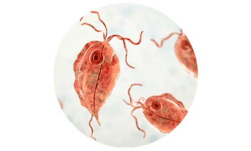 Vaginální infekce způsobené trichomonádami Vaginální infekce způsobené trichomonádami