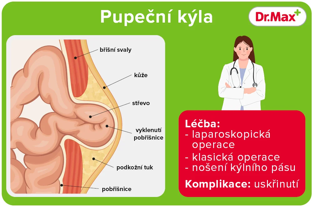 Léčba pupeční kýly Léčba pupeční kýly