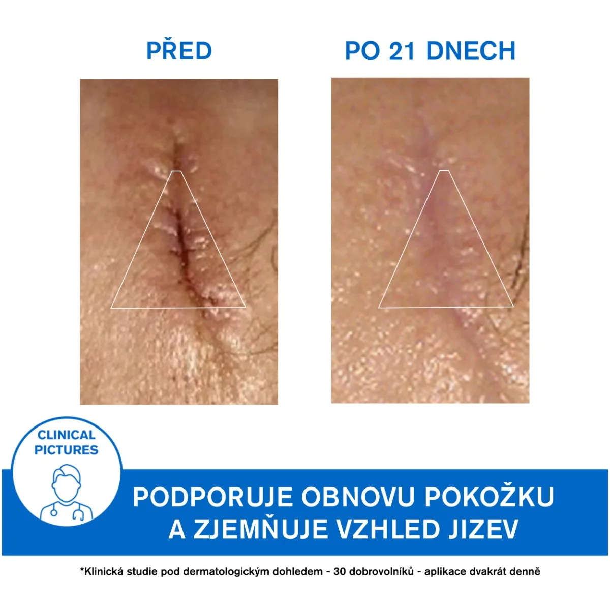Uriage Bariéderm Regenerační krém s obsahem mědi a zinku 40 ml