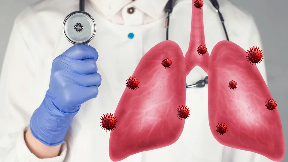 Mykoplazmové infekce – příznaky a léčba